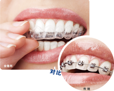 【福州】牙齿不齐，怎么矫正，会造成生活不便