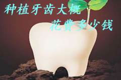 种植牙齿大概要花费多少钱