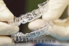 隐形牙套和传统牙套的区别