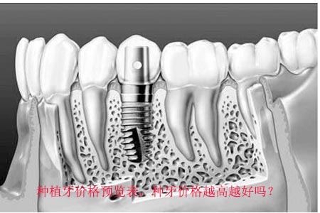 u=2835885808,1894185394&fm=27&gp=0.jpg