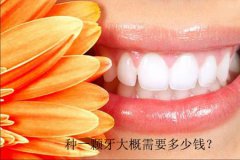 种一颗牙大概需要多少钱？