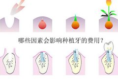 哪些因素会影响种植牙的费用？
