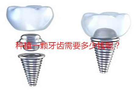 图片31.png