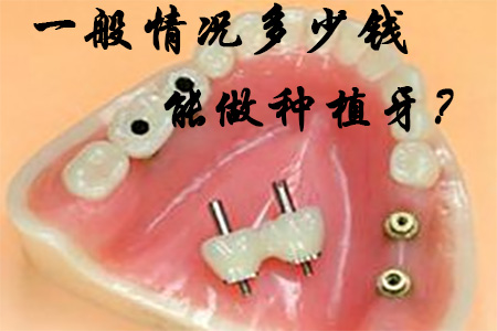 图片25.png