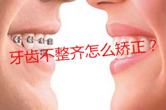 不整齐的牙齿怎么矫正？牙齿正畸一般多少钱？