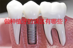 做种植牙的误区有哪些？