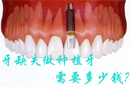 图片20.png
