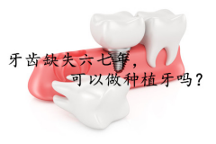 牙齿缺失六七年，可以做种植牙吗？