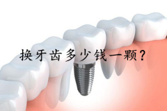 换牙齿需要多少钱一颗？