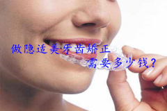 做隐适美牙齿矫正需要多少钱？