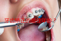 牙齿矫正有年龄限制吗？牙齿矫正的黄金年龄？