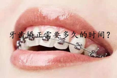 牙齿矫正需要多久的时间？
