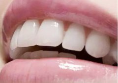 牙齿怎么才能变白？