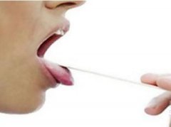 造成口干舌燥的因素有哪些？
