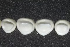 牙齿咬碎了一点怎么办？