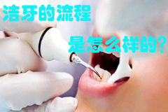 【福州】洁牙的流程是怎么样的？