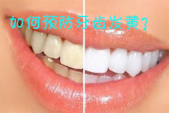 如何预防牙齿发黄？