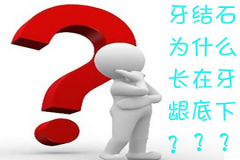牙结石为什么长在牙龈底下？