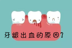 牙龈出血的原因，应该如何预防牙龈出血