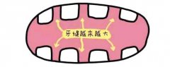 为什么不能使用劣质的牙签？