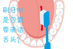 刷牙时是否需要清洁舌头？