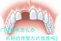 门牙缺失怎么办，有好的修复方式推荐吗？