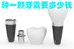 福州种一颗牙所需的费用？