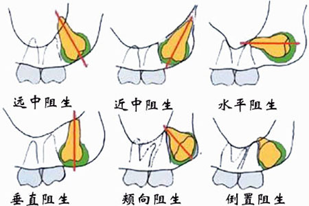 图片11.png