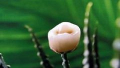 福州种植牙哪里做好？