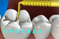 福州补牙的费用高吗，一般多少钱？