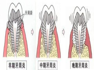 图片 3.png