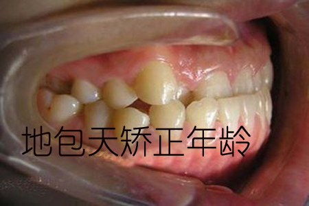图片 1.png