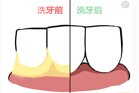 图片12.png