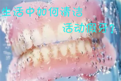 生活中如何清洁活动假牙？