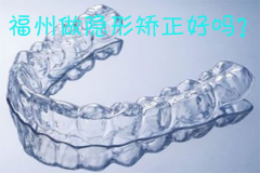 福州做隐形矫正好吗？安全吗？