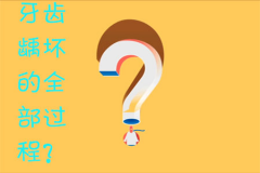 牙齿龋坏的全部过程？