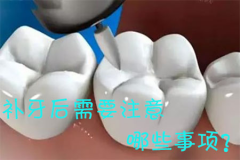 补牙后需要注意哪些事项？