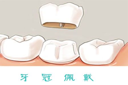 图片15.png