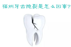 福州牙齿隐裂是怎么回事？