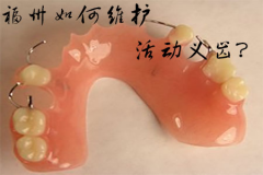 福州如何维护活动义齿？