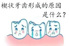 楔状牙齿形成的原因是什么？