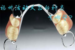 福州活动义齿的种类有哪些？