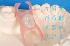 了解可摘局部义齿的优缺点