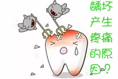同样是龋坏，为什么有些人会产生疼痛有些则不