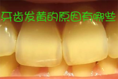 牙齿发黄的原因有哪些？可以怎么样进行处理？