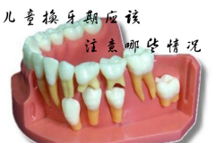 儿童换牙期应该注意哪些情况