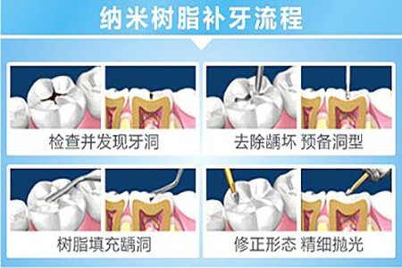 图片11.png