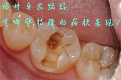 福州牙齿龋坏有哪些特殊的症状表现？