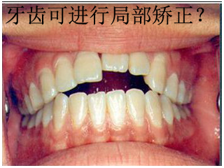 图片 1.png