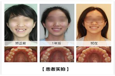 图片 3.png